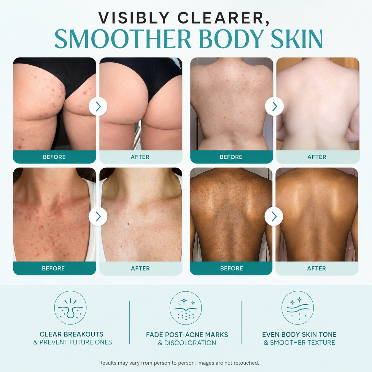 Clearer, smoother body skin in as little as 2 weeks