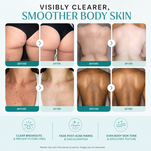 Clearer, smoother body skin in as little as 2 weeks